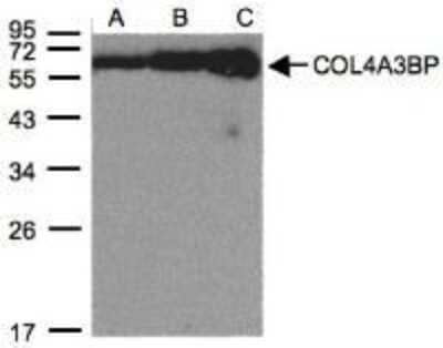 Western Blot COL4A3BP Antibody