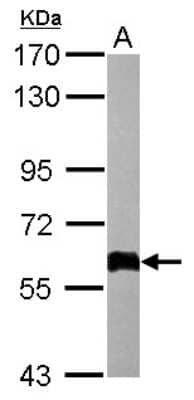 Western Blot: COL4A3BP Antibody [NBP1-31118] - Sample (50 ug of whole cell lysate) A: Mouse white adipose 7. 5% SDS PAGE diluted at 1:1000.