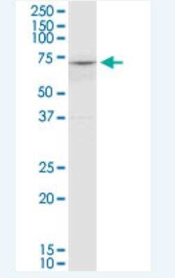 Western Blot COL8A2 Antibody (1F4)