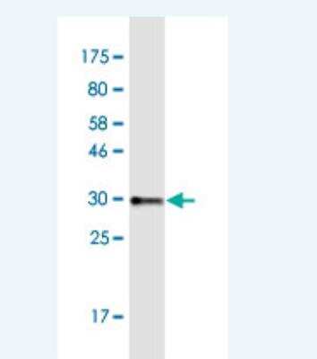 Western Blot COL8A2 Antibody (1F4)