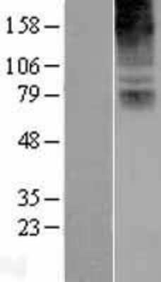 Western Blot: COL8A2 Overexpression Lysate (Adult Normal) [NBL1-09359] Left-Empty vector transfected control cell lysate (HEK293 cell lysate); Right -Over-expression Lysate for COL8A2.