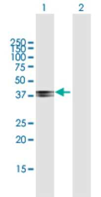 Western Blot: COL9A1 Antibody [H00001297-B01P] - Analysis of COL9A1 expression in transfected 293T cell line by COL9A1 polyclonal antibody.  Lane 1: COL9A1 transfected lysate(36.08 KDa). Lane 2: Non-transfected lysate.