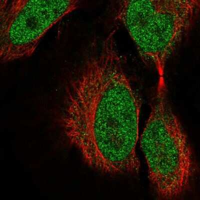 Immunocytochemistry/Immunofluorescence: COL9A3 Antibody [NBP2-58158] - Staining of human cell line HeLa shows localization to nucleoplasm.