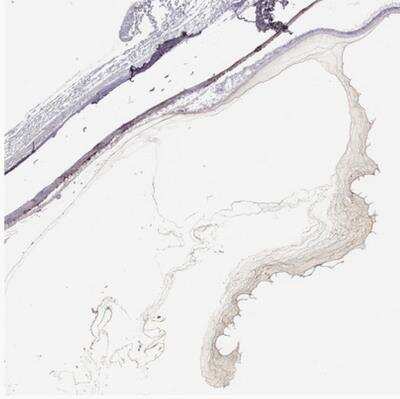 Immunohistochemistry-Paraffin: COL9A3 Antibody [NBP1-85161] - Staining of human eye shows strong staining in positivity in vitreous humor.