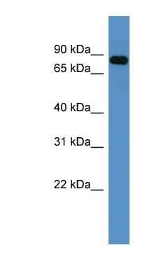 Western Blot: COL9A3 Antibody [NBP1-68937] - Human Heart lysate, concentration 0.2-1 ug/ml.