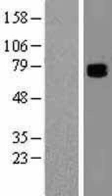 Western Blot: COL9A3 Overexpression Lysate (Adult Normal) [NBL1-09360] Left-Empty vector transfected control cell lysate (HEK293 cell lysate); Right -Over-expression Lysate for COL9A3.