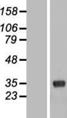 Western Blot: COLEC11 Overexpression Lysate (Adult Normal) [NBL1-09361] Left-Empty vector transfected control cell lysate (HEK293 cell lysate); Right -Over-expression Lysate for COLEC11.