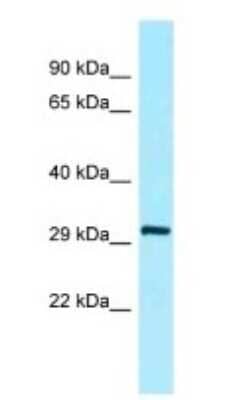 Western Blot COLEC5 Antibody