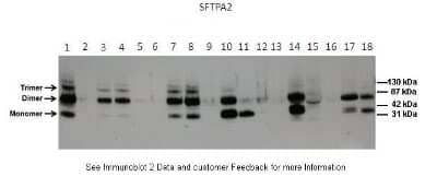 Western Blot COLEC5 Antibody