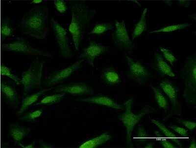 Immunocytochemistry/Immunofluorescence: COMMD1 Antibody (2B12) [H00150684-M03] - Analysis of monoclonal antibody to COMMD1 on HeLa cell. Antibody concentration 10 ug/ml