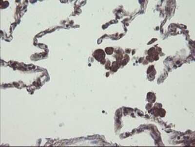 Immunohistochemistry: COMMD1 Antibody (2E2) [NBP2-46331] - Analysis of Human lung tissue.