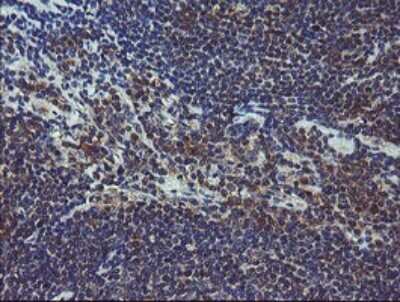 Immunohistochemistry: COMMD1 Antibody (2E2) [NBP2-46331] - Analysis of Human lymphoma tissue.