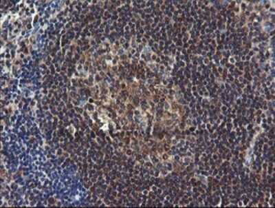 Immunohistochemistry: COMMD1 Antibody (2E2) [NBP2-46331] - Analysis of Human tonsil tissue.