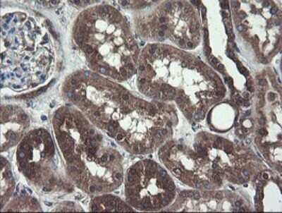 Immunohistochemistry: COMMD1 Antibody (2E2) [NBP2-46331] - Analysis of Human Kidney tissue.