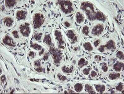 Immunohistochemistry: COMMD1 Antibody (2E2) [NBP2-46331] - Analysis of Human breast tissue.