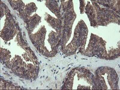 Immunohistochemistry: COMMD1 Antibody (2E2) [NBP2-46331] - Analysis of Human prostate tissue.