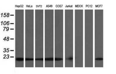 Western Blot: COMMD1 Antibody (2E2) [NBP2-46331] - Analysis of extracts (35ug) from 9 different cell lines (HepG2: human; HeLa: human; SVT2: mouse; A549: human; COS7: monkey; Jurkat: human; MDCK: canine; PC12: rat; MCF7: human).