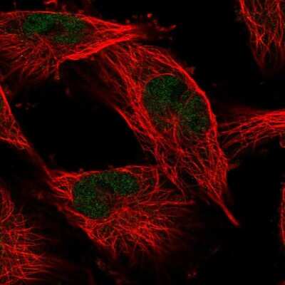 Immunocytochemistry/Immunofluorescence: COMMD1 Antibody [NBP2-55468] - Staining of human cell line U-251 MG shows localization to nucleoplasm.