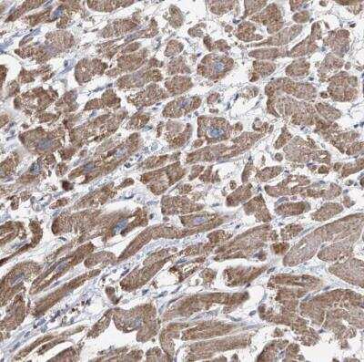 Immunohistochemistry-Paraffin: COMMD1 Antibody [NBP1-86797] - Staining of human heart muscle shows moderate cytoplasmic positivity in myocytes.