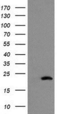 Flow Cytometry: COMMD1 Antibody (OTI1F2) - Azide and BSA Free [NBP2-72419] - HEK293T cells were transfected with the pCMV6-ENTRY control (Left lane) or pCMV6-ENTRY COMMD1 (Right lane) cDNA for 48 hrs and lysed. Equivalent amounts of cell lysates (5 ug per lane) were separated by SDS-PAGE and immunoblotted with anti-COMMD1.