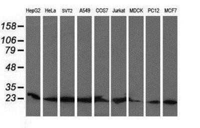 Western Blot: COMMD1 Antibody (OTI1F2) - Azide and BSA Free [NBP2-72419] - Analysis of extracts (35ug) from 9 different cell lines by using anti-COMMD1 monoclonal antibody (HepG2: human; HeLa: human; SVT2: mouse; A549: human; COS7: monkey; Jurkat: human; MDCK: canine; PC12: rat; MCF7: human).