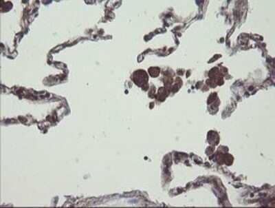 Immunohistochemistry: COMMD1 Antibody (OTI2E2) - Azide and BSA Free [NBP2-72418] - Analysis of Human lung tissue.