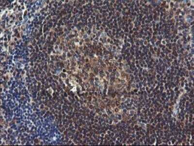 Immunohistochemistry: COMMD1 Antibody (OTI2E2) - Azide and BSA Free [NBP2-72418] - Analysis of Human tonsil tissue.