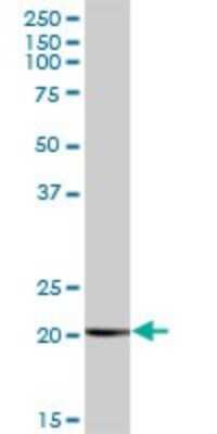 Western Blot: COMMD1 Antibody [H00150684-B01P] - Analysis of COMMD1 expression in human placenta.