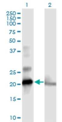 Western Blot: COMMD1 Antibody [H00150684-B01P] - Analysis of COMMD1 expression in transfected 293T cell line by COMMD1 polyclonal antibody.  Lane 1: COMMD1 transfected lysate(20.9 KDa). Lane 2: Non-transfected lysate.