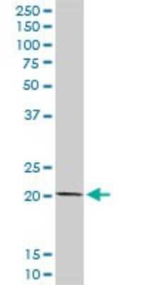 Western Blot: COMMD1 Antibody [H00150684-D01P] - Analysis of COMMD1 expression in HepG2.