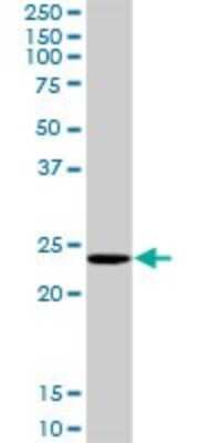 Western Blot: COMMD1 Antibody [H00150684-D01P] - Analysis of COMMD1 expression in mouse liver.
