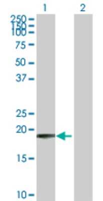 Western Blot: COMMD1 Antibody [H00150684-D01P] - Analysis of COMMD1 expression in transfected 293T cell line by COMMD1 polyclonal antibody.Lane 1: COMMD1 transfected lysate(21.20 KDa).Lane 2: Non-transfected lysate.