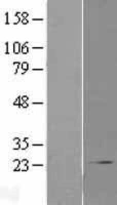 Western Blot: COMMD1 Overexpression Lysate (Adult Normal) [NBL1-09365] Left-Empty vector transfected control cell lysate (HEK293 cell lysate); Right -Over-expression Lysate for COMMD1.