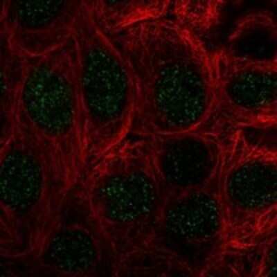 Immunocytochemistry/Immunofluorescence: COMMD10 Antibody [NBP3-17233] - Staining of human cell line MCF7 shows localization to nucleoplasm.