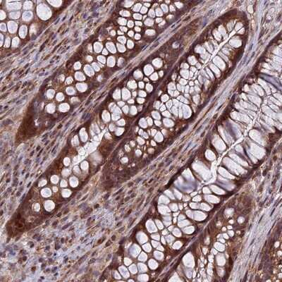 Immunohistochemistry-Paraffin: COMMD2 Antibody [NBP1-91802] - Staining of human rectum shows strong cytoplasmic and nuclear positivity in glandular cells.