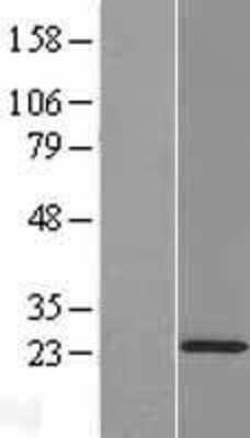 Western Blot: COMMD2 Overexpression Lysate (Adult Normal) [NBL1-09367] Left-Empty vector transfected control cell lysate (HEK293 cell lysate); Right -Over-expression Lysate for COMMD2.