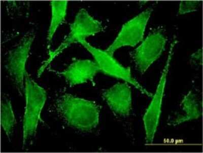 Immunocytochemistry/Immunofluorescence: COMMD3 Antibody (2E2) [H00023412-M01] - Analysis of monoclonal antibody to COMMD3 on HeLa cell . Antibody concentration 10 ug/ml.