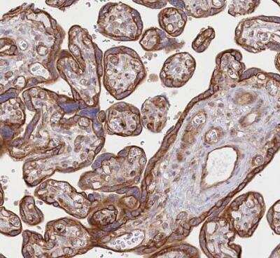 Immunohistochemistry-Paraffin: COMMD3 Antibody [NBP1-88519] - Staining of human placenta shows strong membranous and cytoplasmic positivity in trhophoblastic cells.
