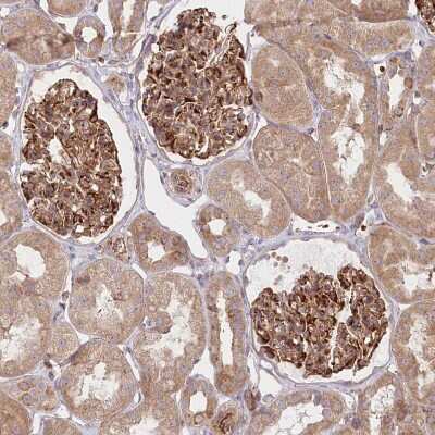 Immunohistochemistry-Paraffin: COMMD3 Antibody [NBP1-88519] - Staining of human Kidney shows strong cytoplasmic positivity in cells in glomeruli and tubules.