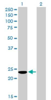 Western Blot: COMMD3 Antibody [H00023412-B01P] - Analysis of COMMD3 expression in transfected 293T cell line by COMMD3 polyclonal antibody.  Lane 1: COMMD3 transfected lysate(21.45 KDa). Lane 2: Non-transfected lysate.