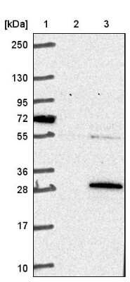 Western Blot: COMMD3 Antibody [NBP1-88519] - Lane 1: Marker [kDa] 250, 130, 95, 72, 55, 36, 28, 17, 10&lt;br/&gt;Lane 2: Negative control (vector only transfected HEK293T lysate)&lt;br/&gt;Lane 3: Over-expression lysate (Co-expressed with a C-terminal myc-DDK tag (3.1 kDa) in mammalian HEK293T cell).