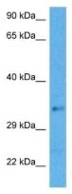 Western Blot: COMMD3-BMI1 Antibody [NBP3-10063] - Western blot analysis of COMMD3-BMI1 in Human HCT116 Whole Cell lysates. Antibody dilution at 1ug/ml