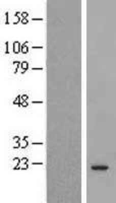 Western Blot: COMMD3 Overexpression Lysate (Adult Normal) [NBL1-09368] Left-Empty vector transfected control cell lysate (HEK293 cell lysate); Right -Over-expression Lysate for COMMD3.