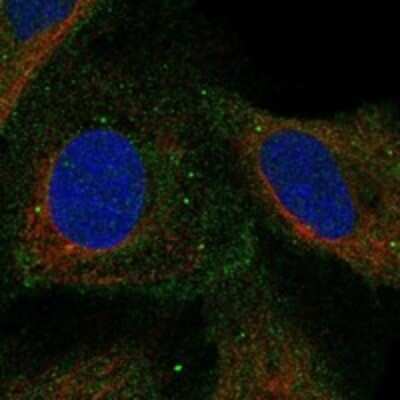 Immunocytochemistry/Immunofluorescence: COMMD4 Antibody [NBP3-17578] - Staining of human cell line U-2 OS shows localization to plasma membrane, cytosol & vesicles.