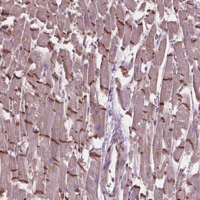 Immunohistochemistry-Paraffin: COMMD4 Antibody [NBP2-49500] - Staining of human heart muscle shows strong positivity of intercalated discs.