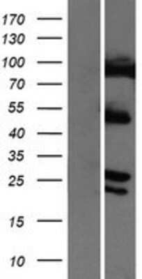 Western Blot: COMMD4 Overexpression Lysate (Adult Normal) [NBP2-06911] Left-Empty vector transfected control cell lysate (HEK293 cell lysate); Right -Over-expression Lysate for COMMD4.