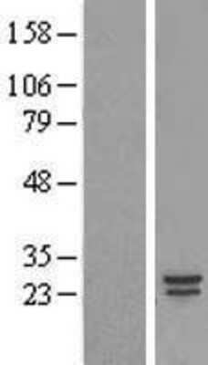 Western Blot: COMMD5 Overexpression Lysate (Adult Normal) [NBL1-09369] Left-Empty vector transfected control cell lysate (HEK293 cell lysate); Right -Over-expression Lysate for COMMD5.
