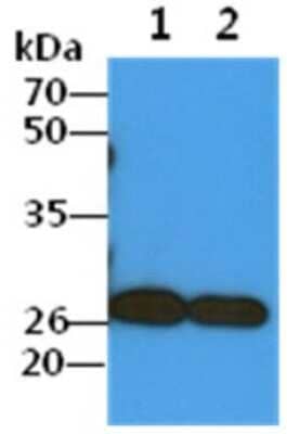 Western Blot: COMMD7 Antibody (49B5) [NBP2-59423] - Lane 1: A549 cell lysates, Lane 2: HepG2 cell lysates