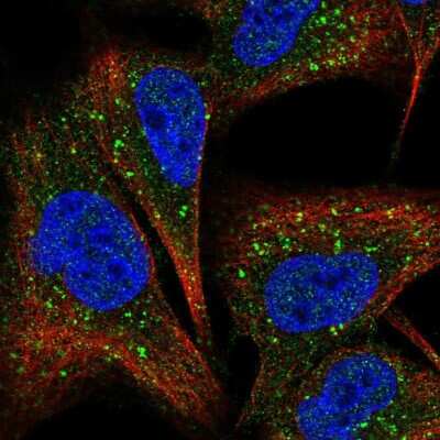 Immunocytochemistry/Immunofluorescence: COMMD7 Antibody [NBP2-58399] - Staining of human cell line A549 shows localization to vesicles.