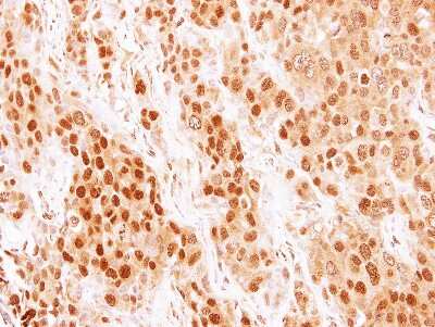 Immunohistochemistry-Paraffin: COMMD7 Antibody [NBP1-31697] - Paraffin-embedded BT474 xenograft, using antibody at 1:500 dilution.